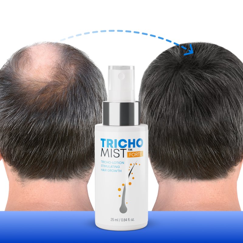 Trichomist Forte - Rozwiązanie dla Ryzyka Struszy i Zaburzeń Łojowych